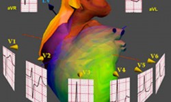 New Cardio, Santa Clara, USA